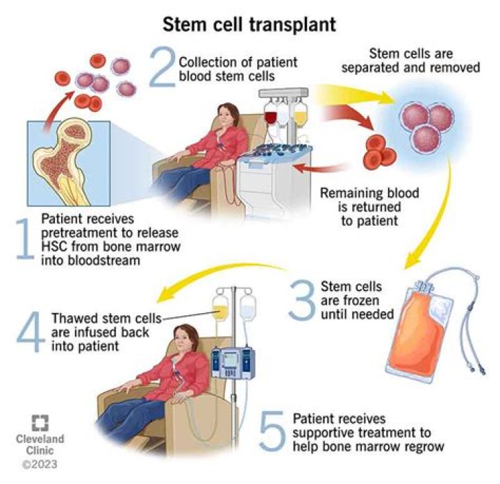What is BMT infusion?