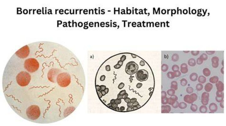 What is Borrelia serology?