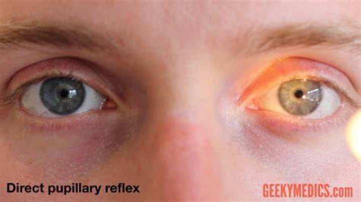 What is direct and consensual pupillary reflex?