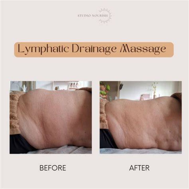 What is lymphatic massage Singapore?