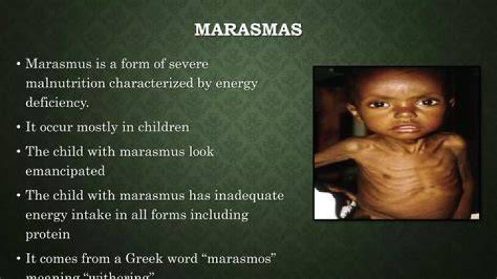 What is marasmus syndrome?