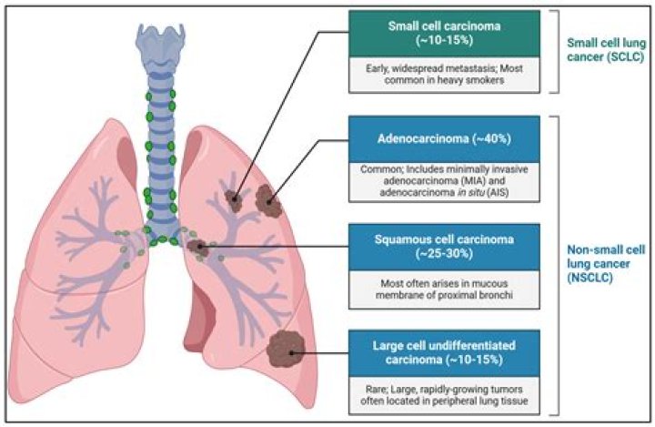 What is T1mi in lung cancer?