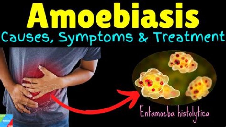 What is the best medicine for Amoebiasis?