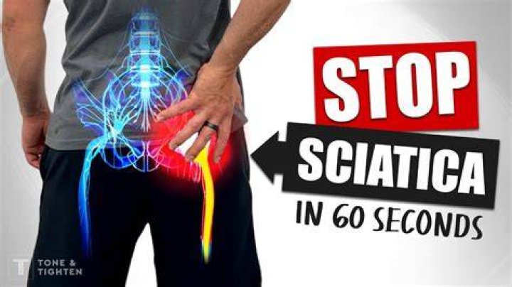 What is the best way to get rid of sciatic nerve pain?