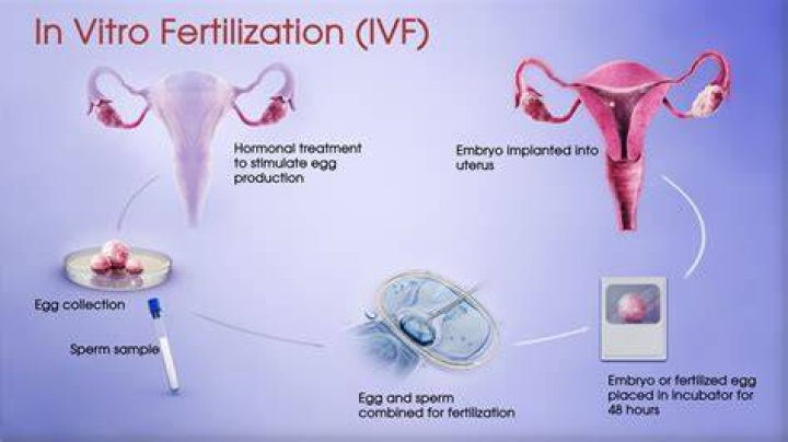 What is the disadvantage of vitro fertilization?