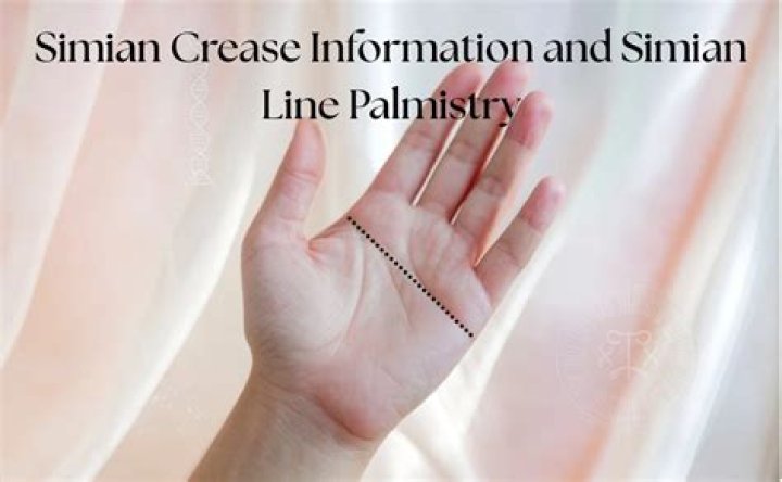 What is the meaning of simian crease?