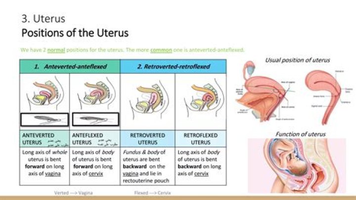 What is the most common cervix position?