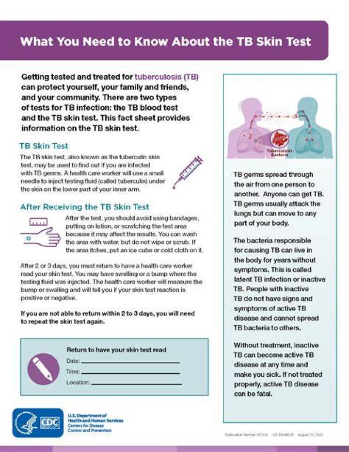 What is the side effects of taking the TB test?