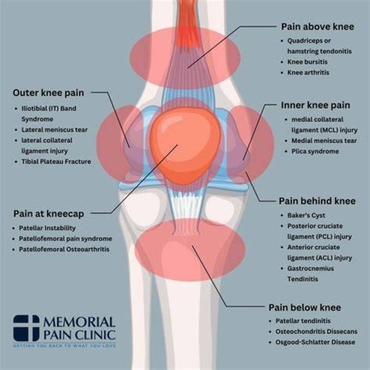 When should I worry about knee pain after a fall?