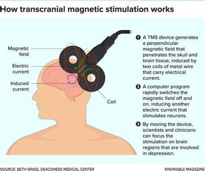 When was transcranial magnetic stimulation approved by the FDA?