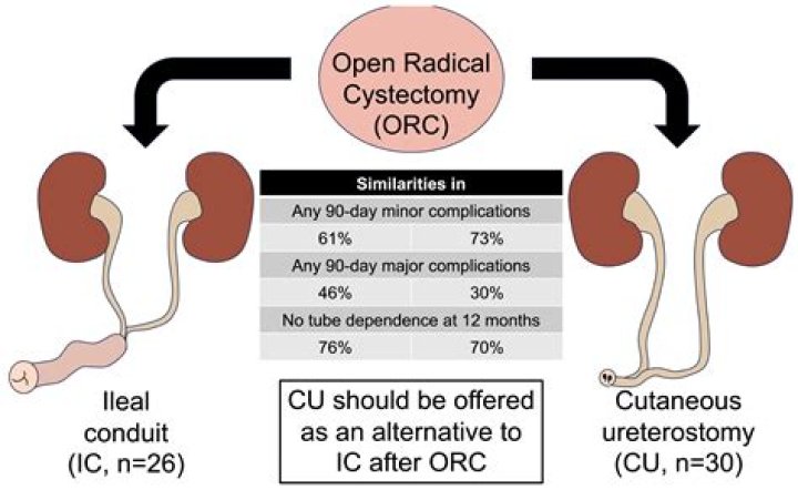 Which is a complication that may occur after urinary diversion surgery?