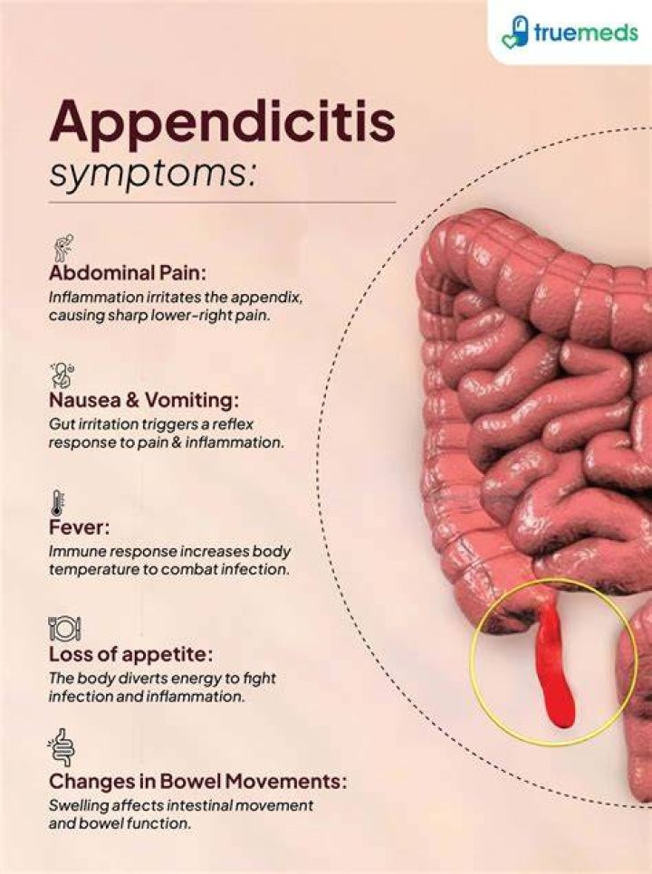 Why appendix carry is bad?