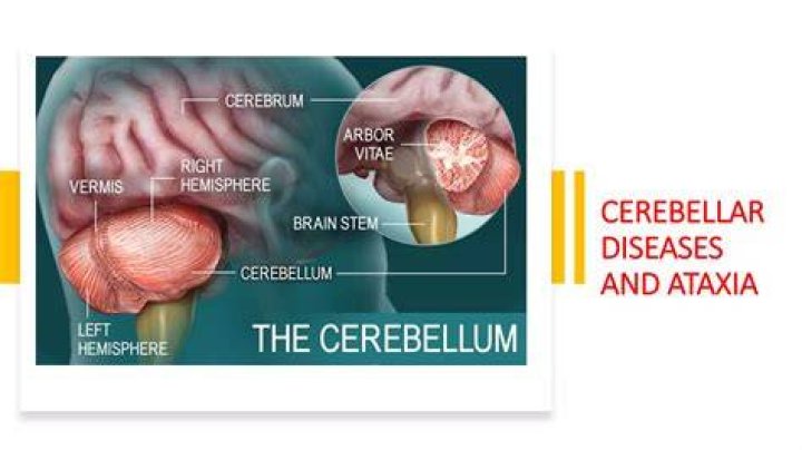 Why there is intention tremor in cerebellar disease?